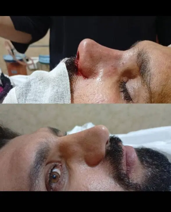 جراحی|خدمات زیبایی و سلامت|امیدیه, |دیوار