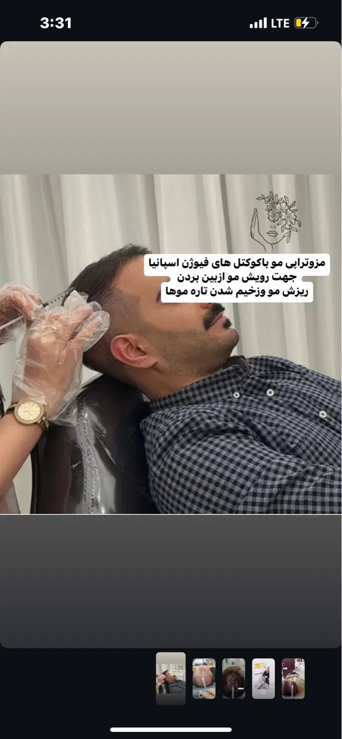 مزوتراپی مو ،برای خانمهاواقایان در کلینیک دی|خدمات آرایشگری و زیبایی|کرمانشاه, |دیوار