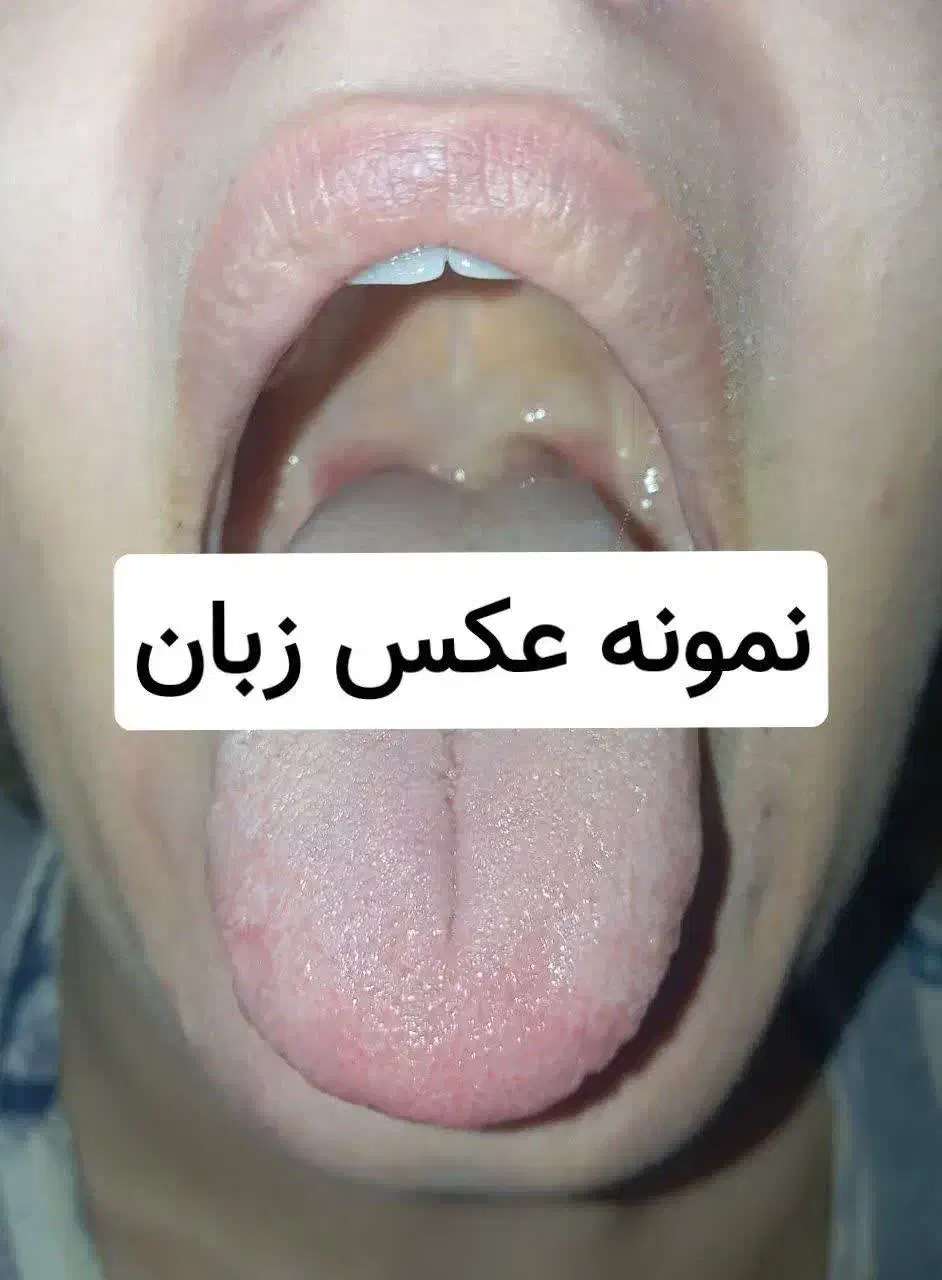 سونوگرافی از روی زبان|خدمات آرایشگری و زیبایی|قم, محمد آباد|دیوار