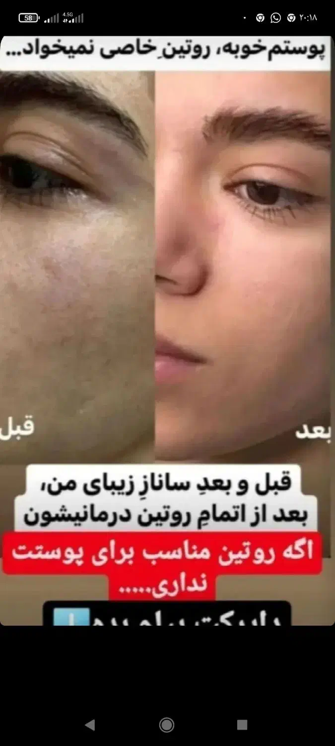 فشیال و پاکسازی سنتی|خدمات آرایشگری و زیبایی|سهند, |دیوار