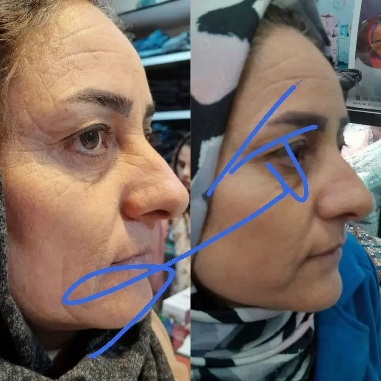 پکیج لاغری و چاقی صادراتی و ضد لک های پوستی|آرایشی، بهداشتی، درمانی|قزوین, |دیوار