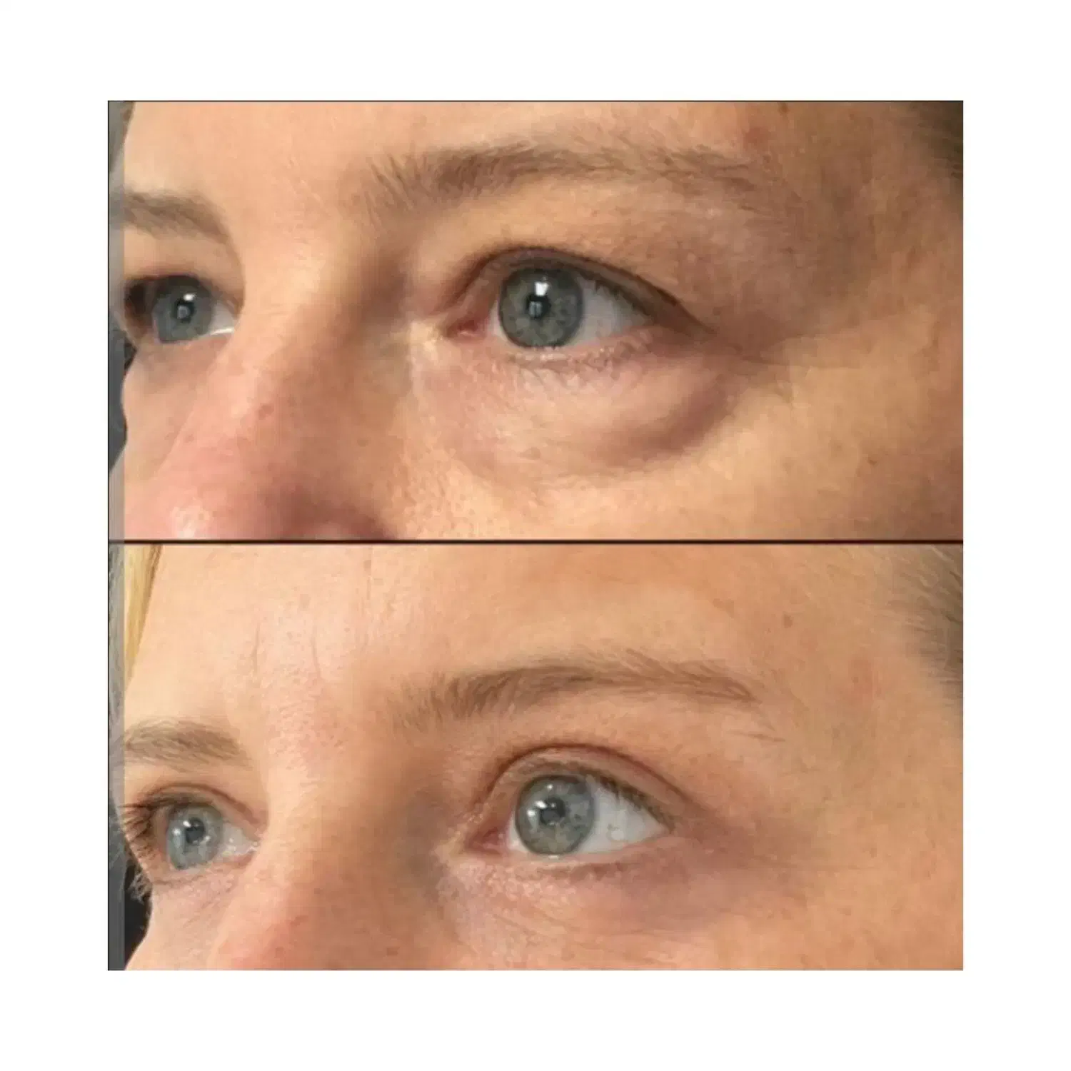 بلافارو/عمل پلک چشم/سلنترال لب|خدمات آرایشگری و زیبایی|اصفهان, مهدی آباد|دیوار