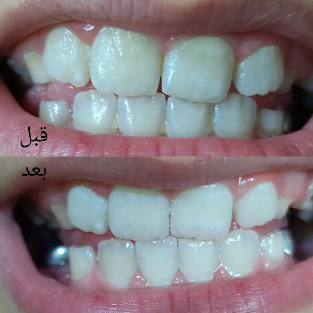 برای استفاده شخصی پک دهان دندان|آرایشی، بهداشتی، درمانی|گلوگاه بابل (گلیا), |دیوار