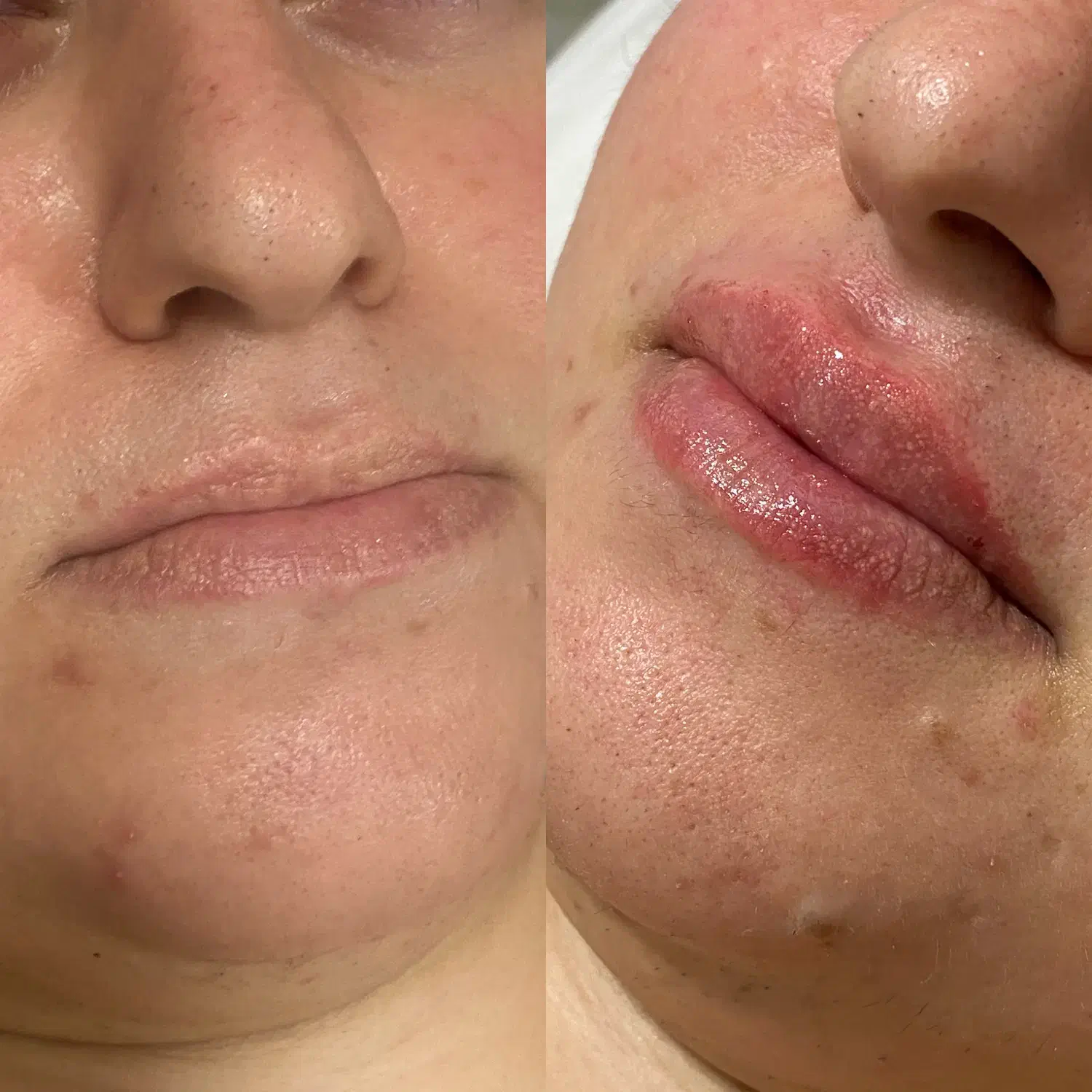 استخدام|استخدام درمانی، زیبایی، بهداشتی|لاهیجان, شیشه گران|دیوار