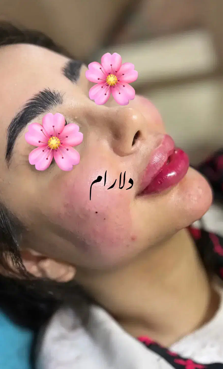 ژل و بوتاکس - مدلنیگ عربی-آموزش حرفه ای|خدمات آرایشگری و زیبایی|شیراز, شهرک مهرگان|دیوار