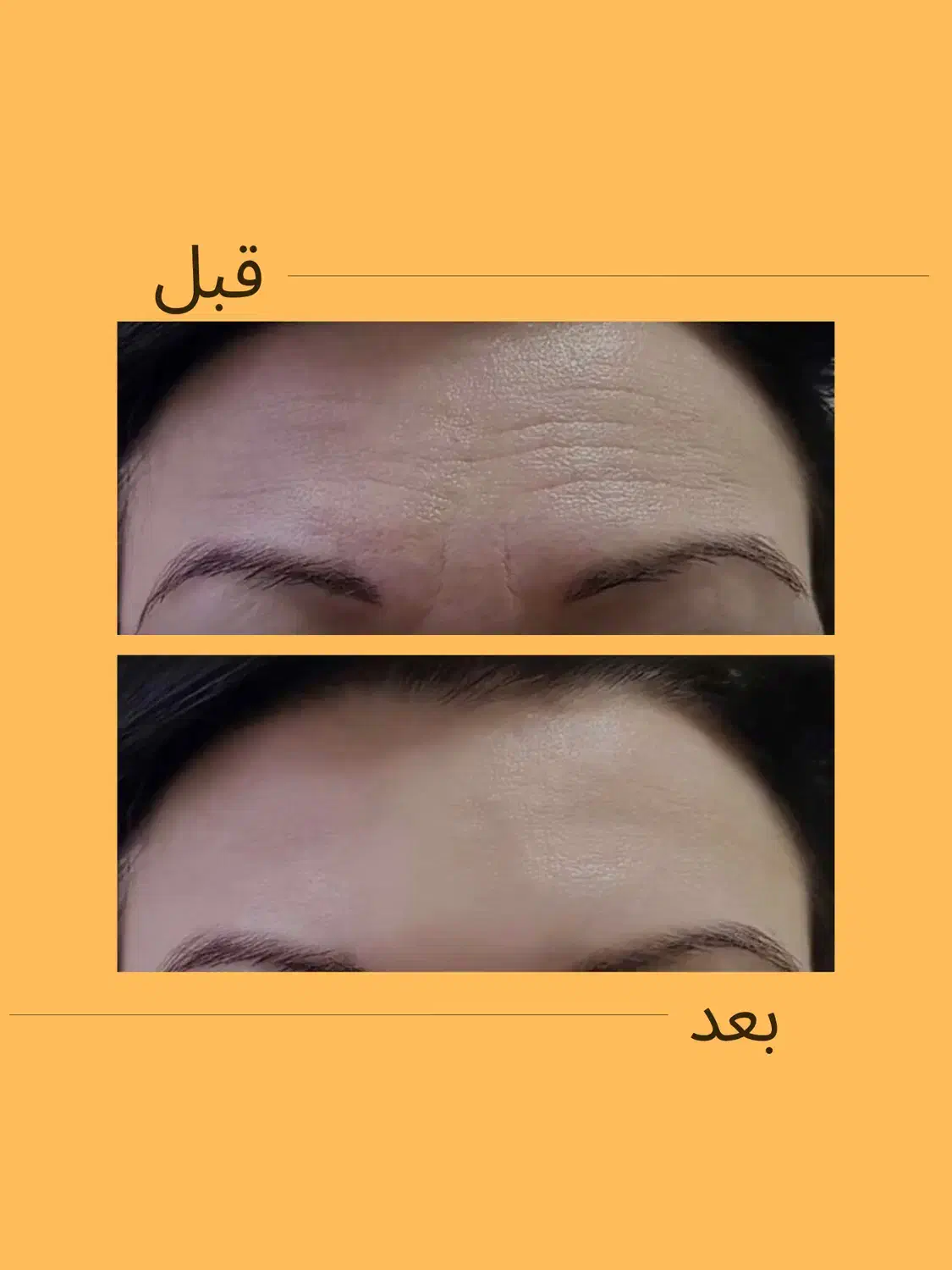 خدمات زیبایی در کلینیک ماهورا|خدمات آرایشگری و زیبایی|بندرعباس, |دیوار