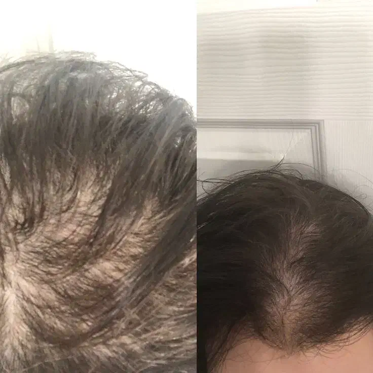 تونیک ضدریزش.رویش مجدد.اصلی.|آرایشی، بهداشتی، درمانی|رامشیر, |دیوار