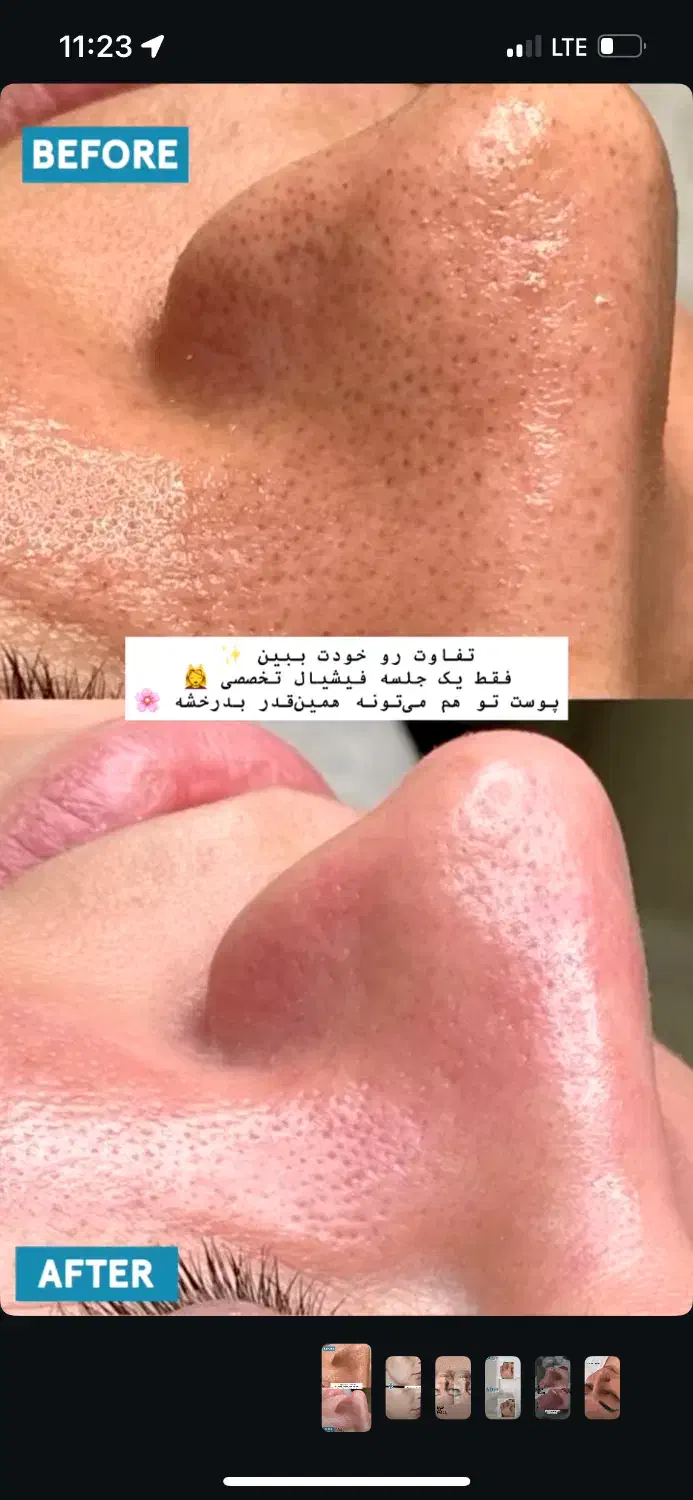 آفر پاکسازی صورت|خدمات آرایشگری و زیبایی|مشهد, ادیب نیشابوری (شهرک غرب)|دیوار