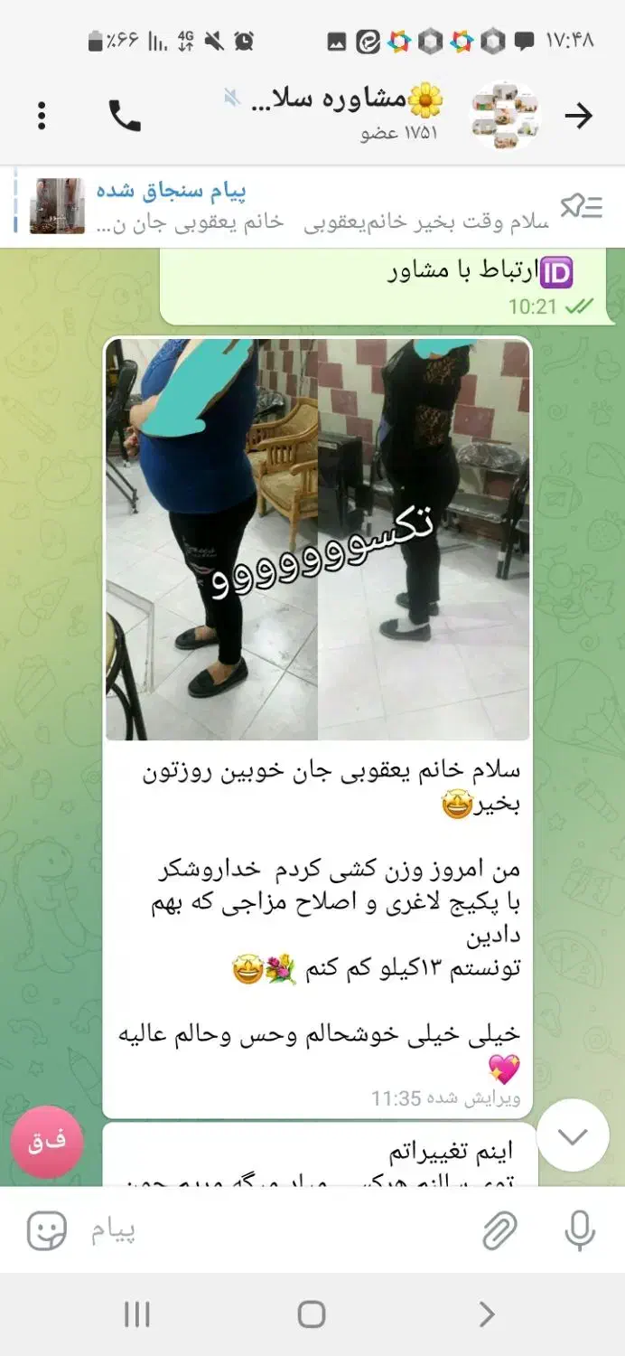 چربیسوزی با تکسوو|آرایشی، بهداشتی، درمانی|قزوین, |دیوار