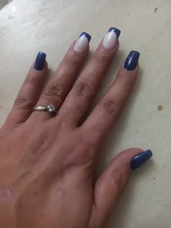 ترمیم و کاشت|خدمات آرایشگری و زیبایی|تهران, تهرانپارس غربی|دیوار