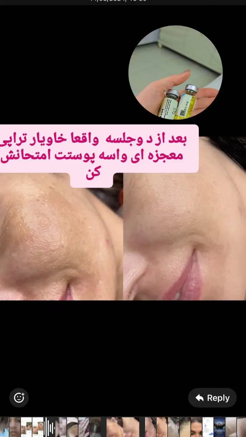 درمان ناهنجاری پوست و آموزش خاویار تراپی|خدمات آرایشگری و زیبایی|شیراز, باهنر|دیوار