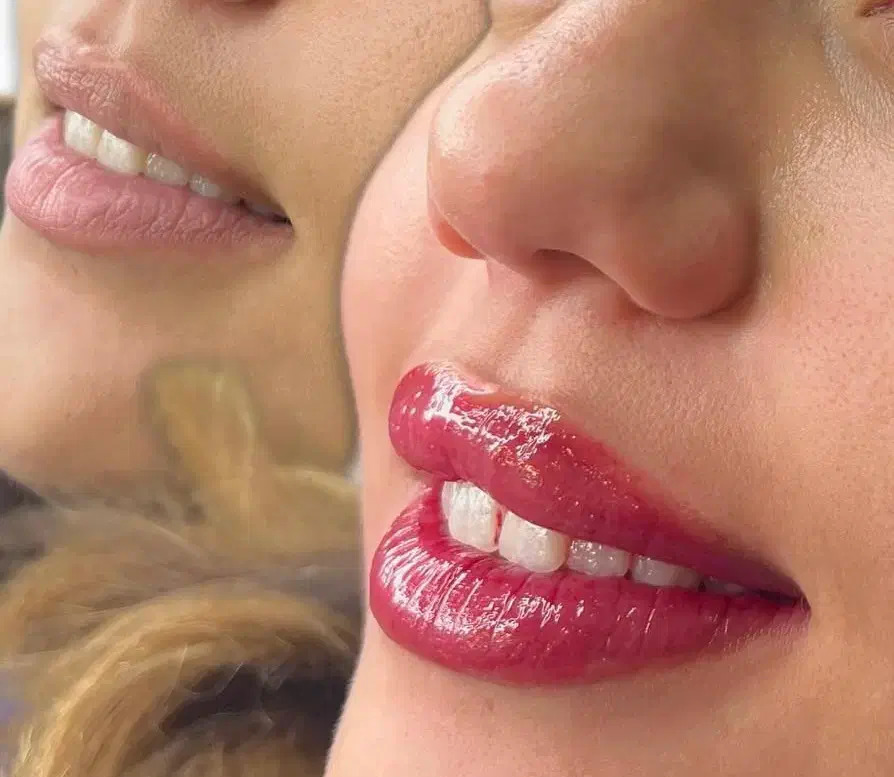 انجام تخصصی فیبرو و میکروبلیدینک وشیدلب|خدمات آرایشگری و زیبایی|شیراز, سیلو|دیوار