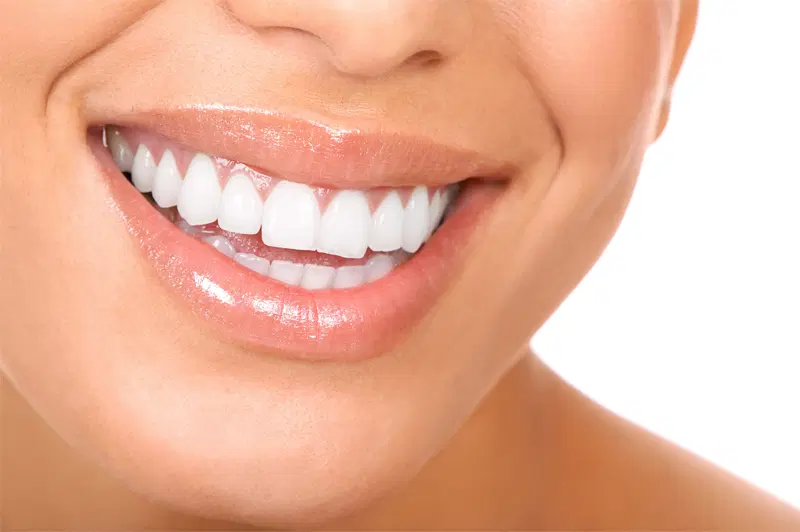 دندان پزشکی پارس|خدمات زیبایی و سلامت|تهران, حبیب الله|دیوار