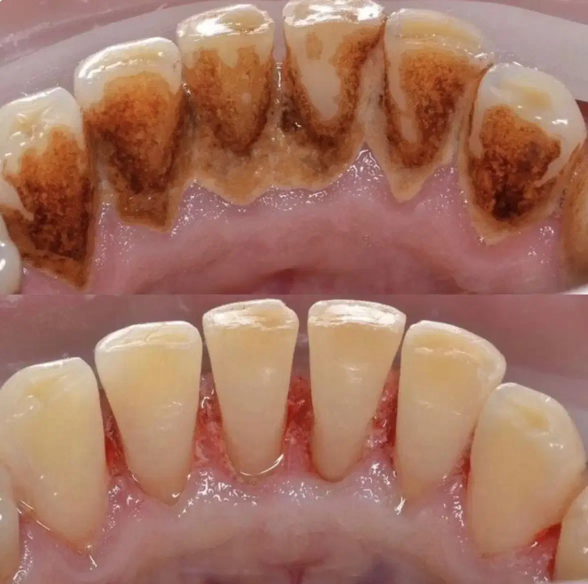 جشنواره یلدایی خدمات دندانپزشکی|خدمات آرایشگری و زیبایی|اردبیل, |دیوار