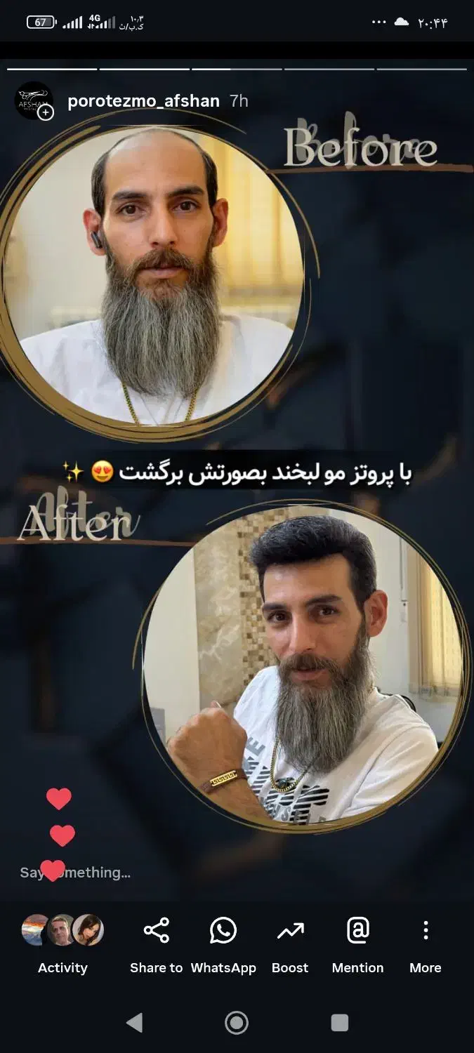 پروتز و ترمیم موی افشان|خدمات آرایشگری و زیبایی|مشهد, کوثر|دیوار