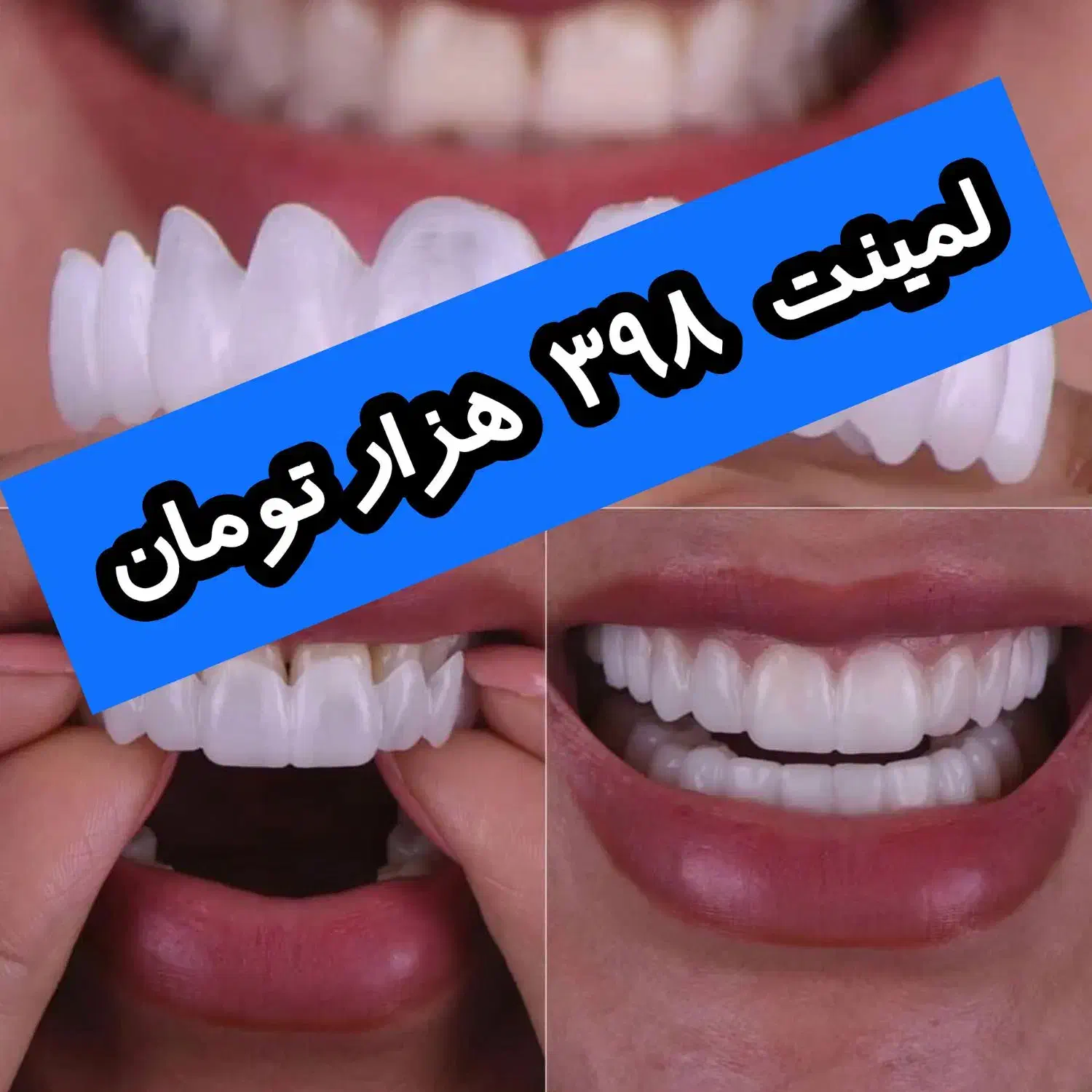 همانند تصاویر و با نرخ درج شده|کفش و لباس بچه|گرگان, |دیوار