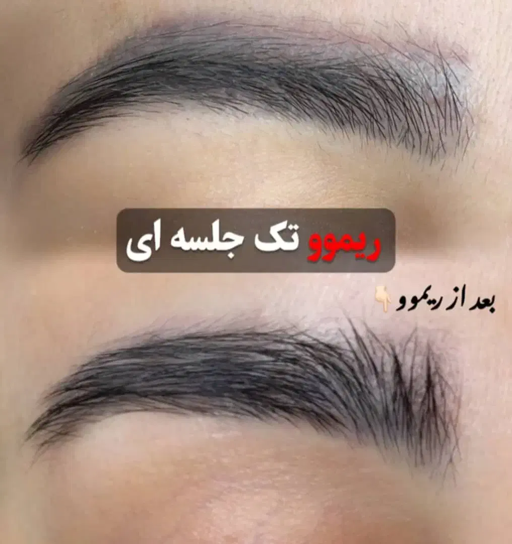 تخصصی پوست و مو و لیزر|خدمات آرایشگری و زیبایی|یاسوج, |دیوار