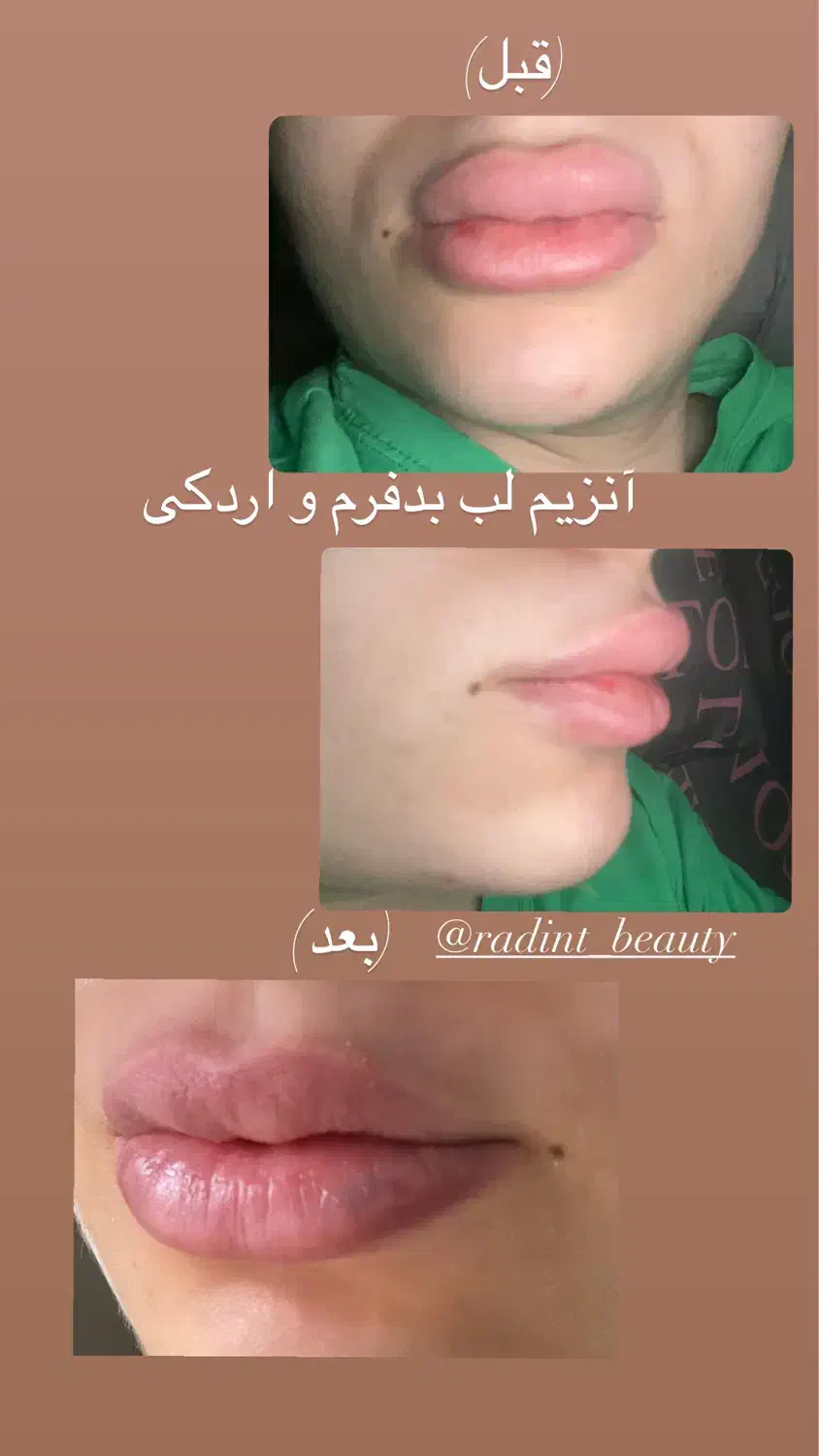 خدمات زیبایی|خدمات آرایشگری و زیبایی|خرمشهر, |دیوار