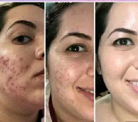 راه حل با طبیعت|آرایشی، بهداشتی، درمانی|زاهدان, |دیوار