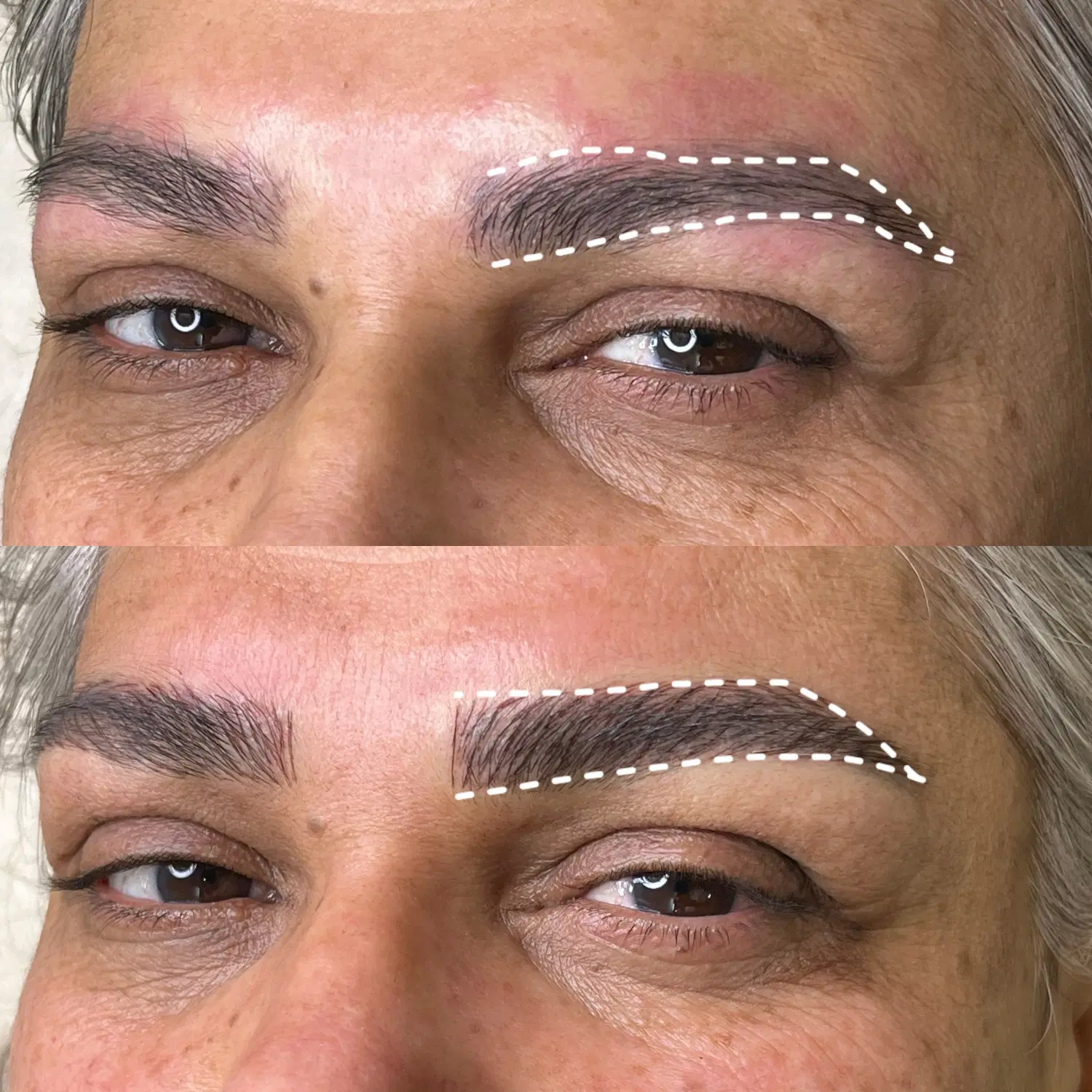 میکروبلیدینگ|خدمات زیبایی و سلامت|رشت, پاستوریزه|دیوار