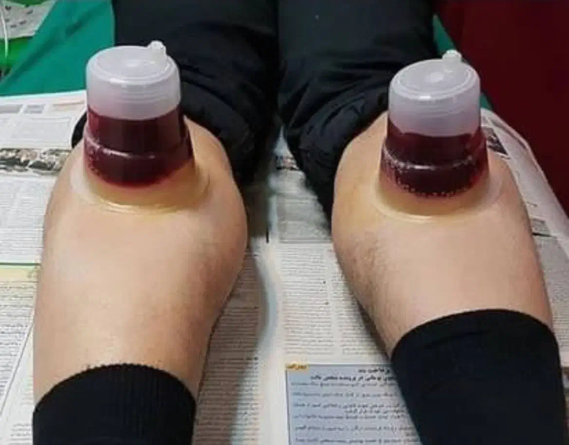 حجامت وبادکش|خدمات آرایشگری و زیبایی|بوشهر, |دیوار