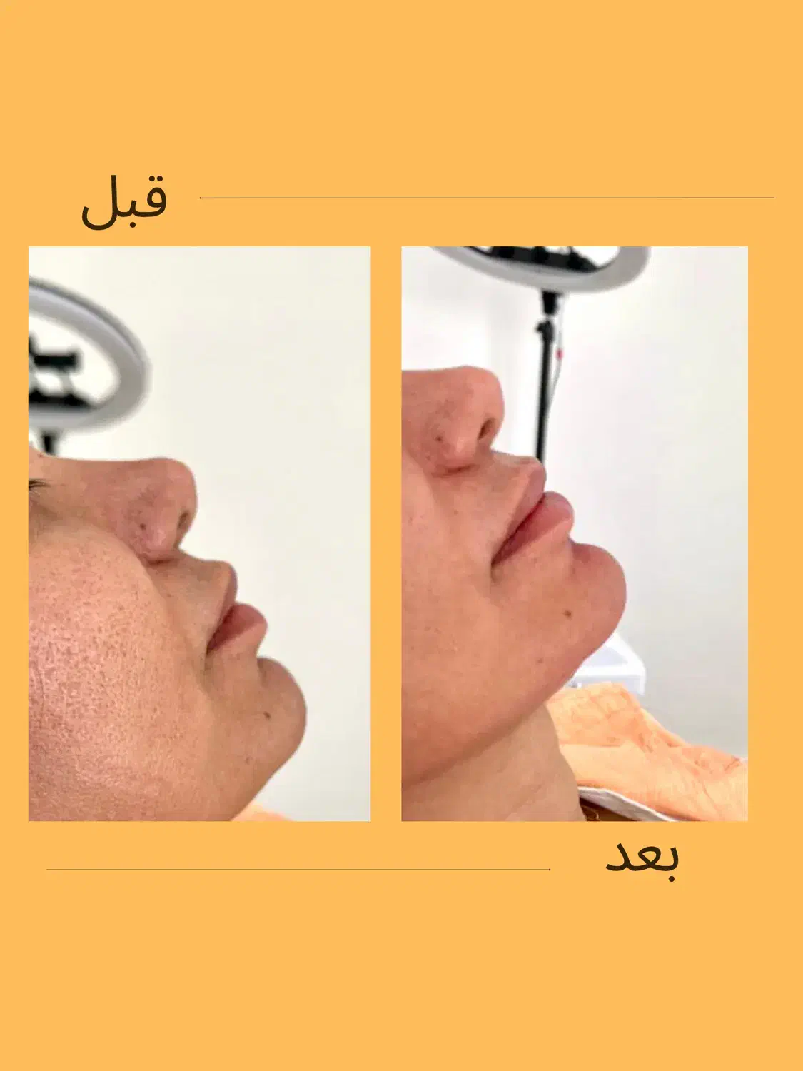 خدمات زیبایی در کلینیک ماهورا|خدمات آرایشگری و زیبایی|بندرعباس, |دیوار