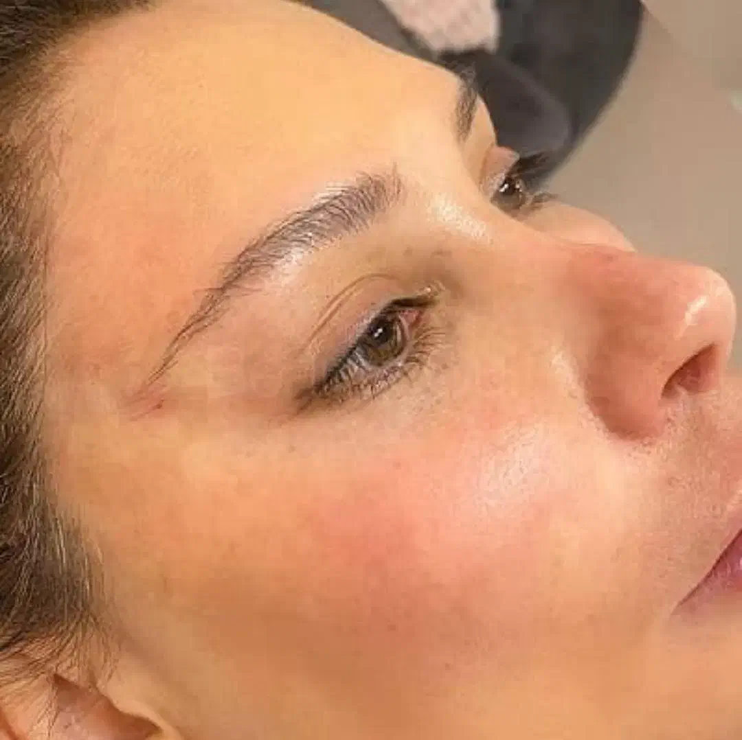 بلفاروپلاستی ۴۵۰۰/غبغب۴۵۰۰/کاشت ابرو|خدمات آرایشگری و زیبایی|ری, دیلمان|دیوار