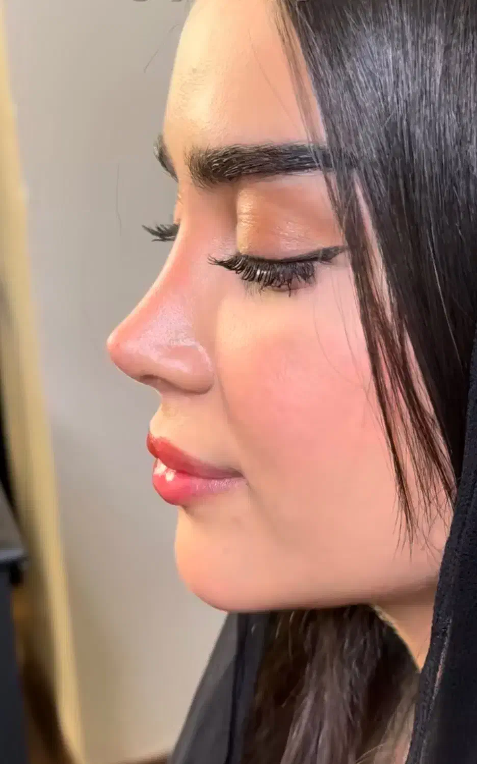 جشنواره عمل بینی ابدو لیفت لیپو ساکشن پیکر تراشی|خدمات آرایشگری و زیبایی|بومهن, |دیوار