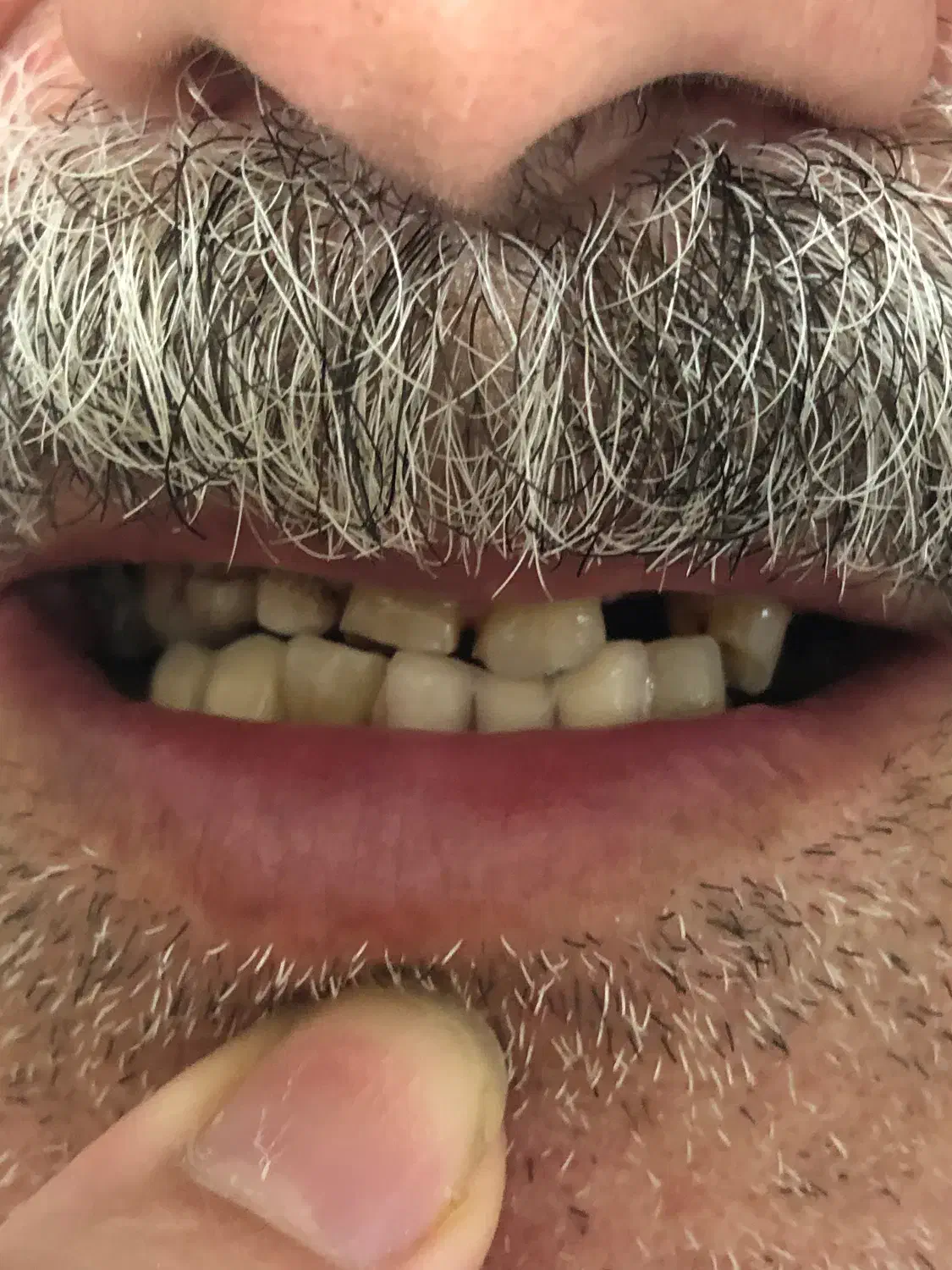 ساخت پروتز مصنوعی|پزشکی|آمل, |دیوار