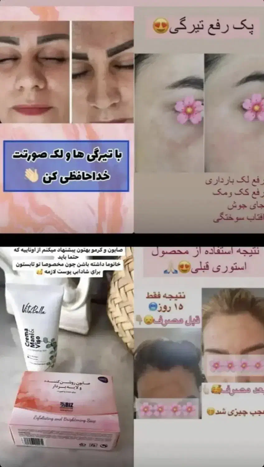 قوی ترین پک روشن کننده|آرایشی، بهداشتی، درمانی|اهواز, امانیه|دیوار