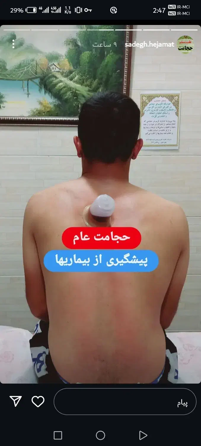 بانوی حجامت یزد|خدمات آموزشی|یزد, |دیوار