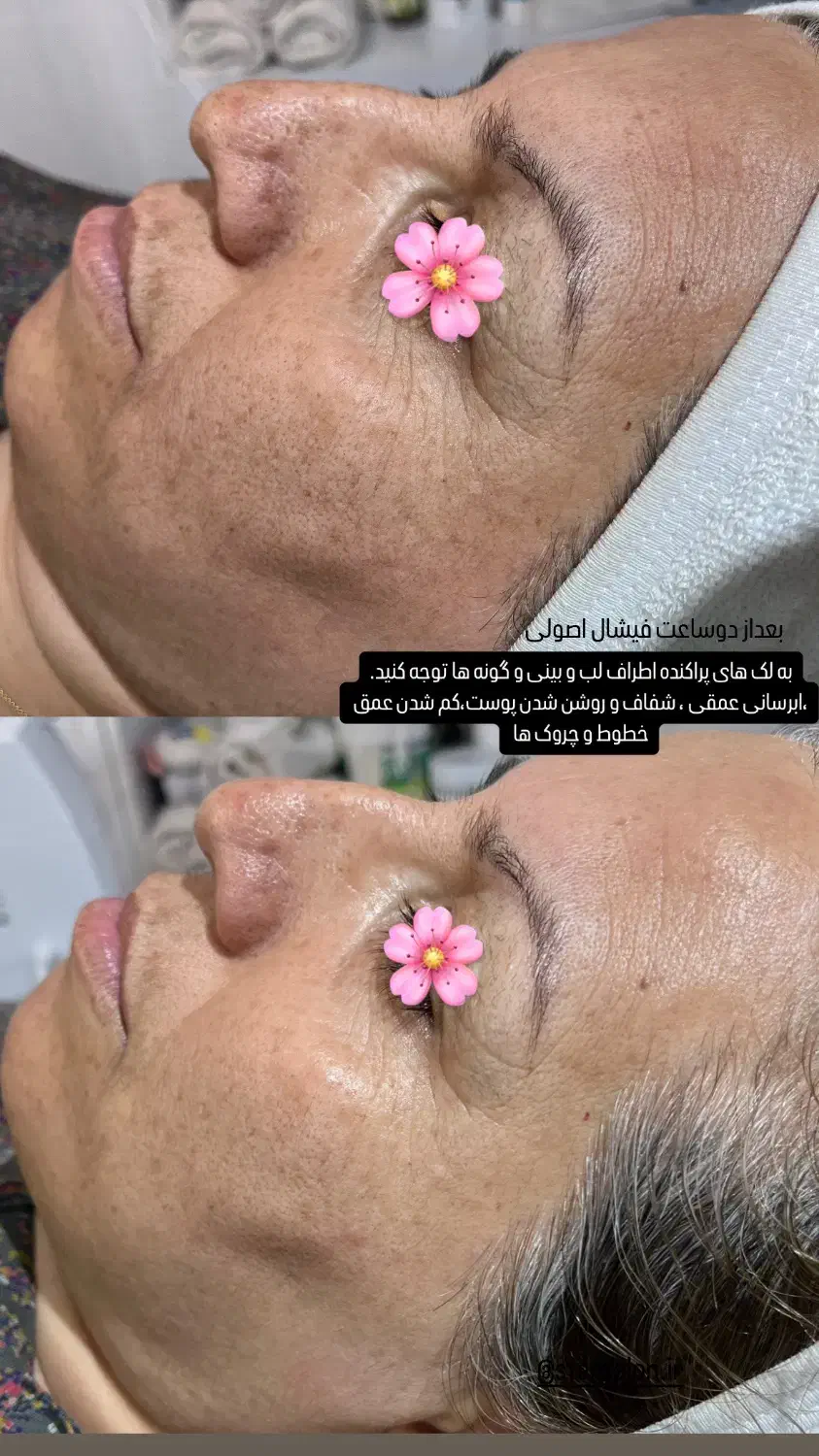 فیشال و پاکسازی صورت|خدمات آرایشگری و زیبایی|شیراز, شهرک فرزانگان|دیوار