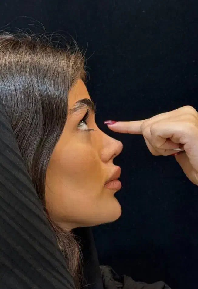 جشنواره جراحی بینی|خدمات آرایشگری و زیبایی|سقز, |دیوار