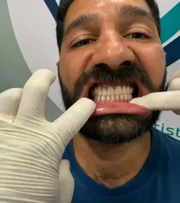 خدمات تخصصی ایمپلنت و اوردنچر|خدمات آرایشگری و زیبایی|اصفهان, کوی ولی عصر|دیوار