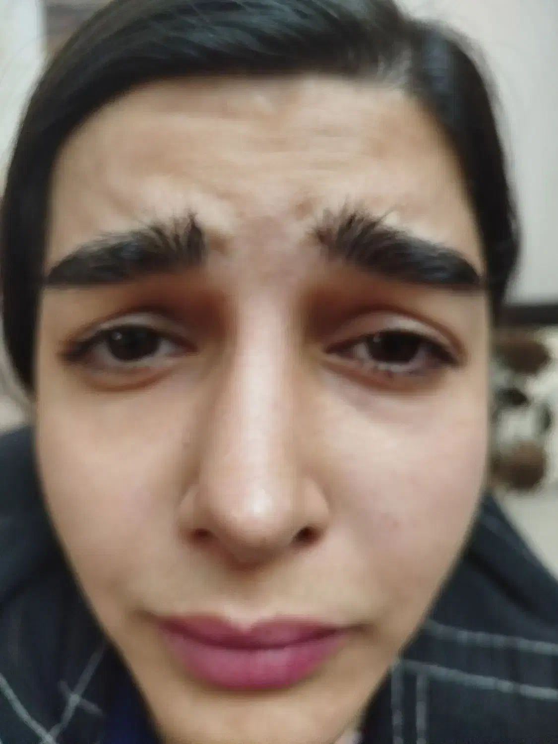 ژل بوتاکس مزو|خدمات آرایشگری و زیبایی|صدرا-فارس, فاز ۱|دیوار