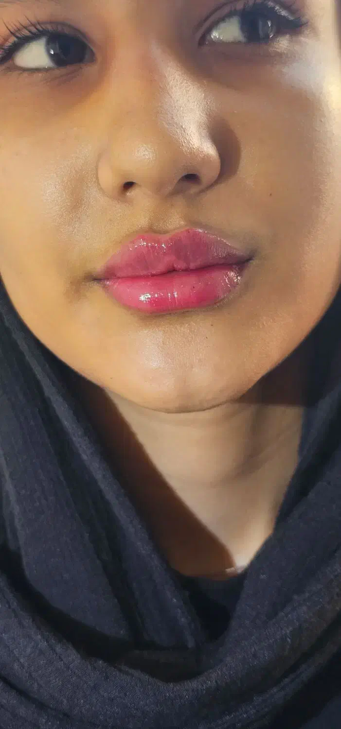 تزریق فیلر بادی بدن۱۲۰هزار|خدمات آرایشگری و زیبایی|جوانرود, |دیوار