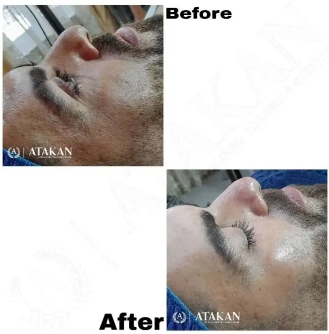 آموزش فیشال و پاکسازی پوست ویژه سال جدید|خدمات آموزشی|خوی, |دیوار