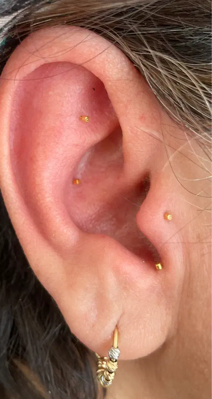 درمان تضمینی بیماری ها با طب سوزنی گوش ای اس پی|خدمات آرایشگری و زیبایی|کرمان, |دیوار