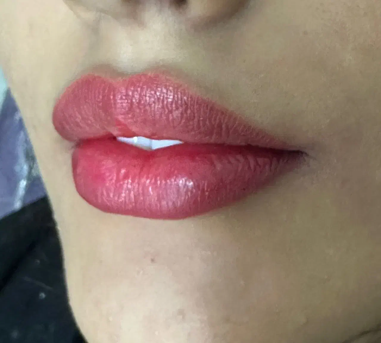 کلینیک پوست ومومایا|خدمات آرایشگری و زیبایی|کرج, شهرک اوج|دیوار