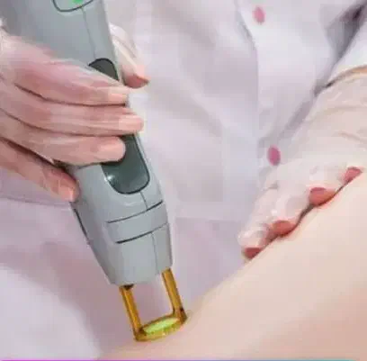 اموزش اپراتوری لیزر موهای زائد هم رولی هم شاتی|خدمات آموزشی|قم, زنبیل آباد|دیوار