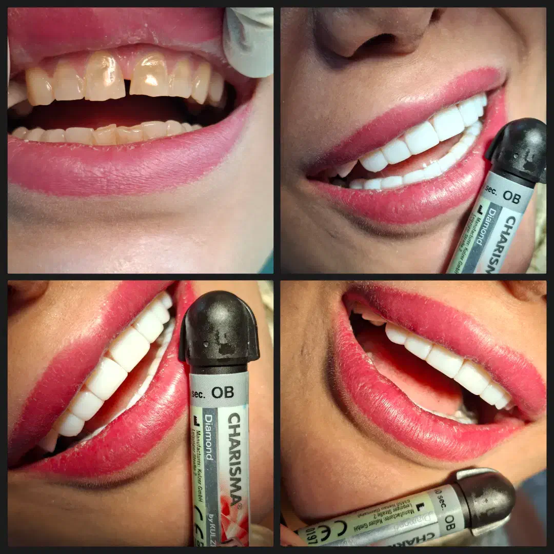 جشنواره دندان پزشکی و کامپوزیت دندان|خدمات آرایشگری و زیبایی|پاکدشت, شهرک امام رضا|دیوار