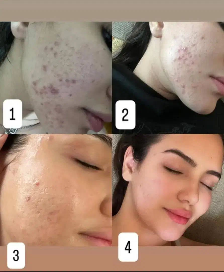 پووست موو|آرایشی، بهداشتی، درمانی|چیتاب, |دیوار