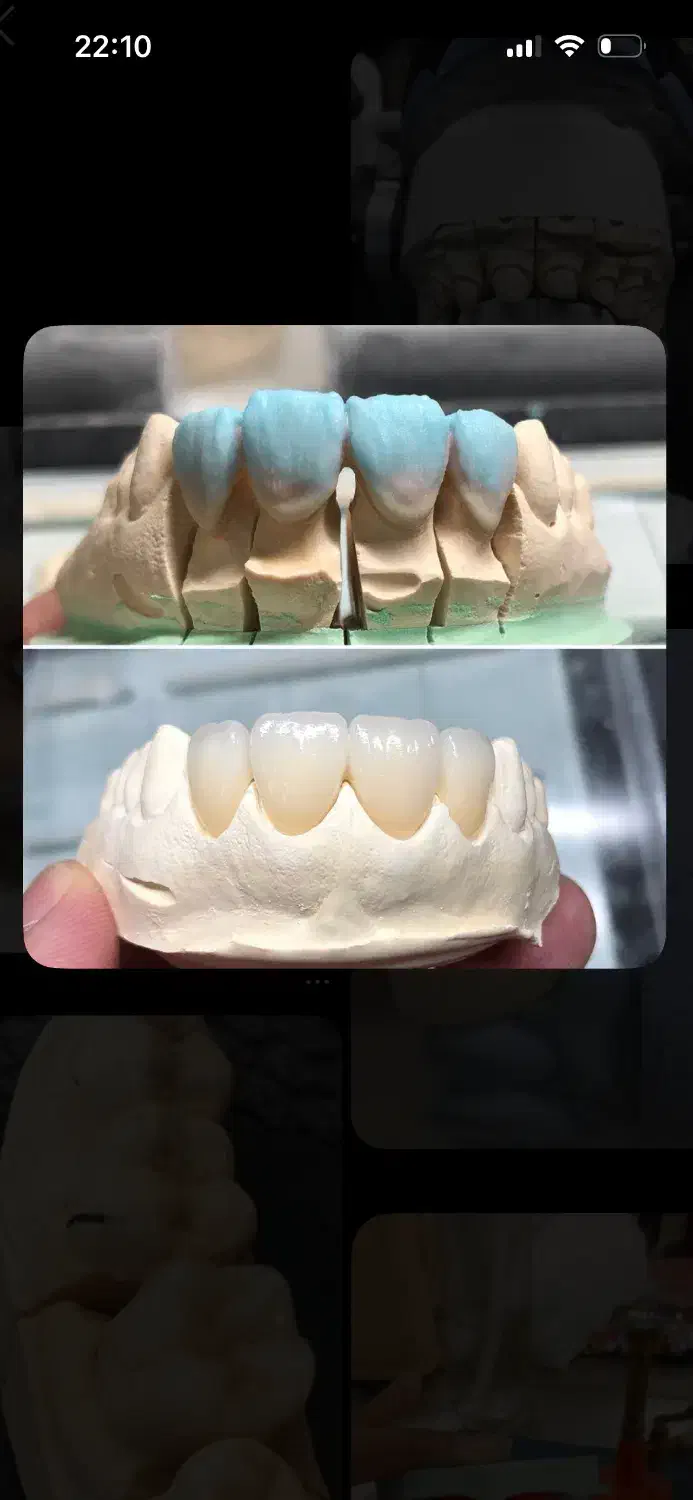 نیروی دندانسازی|استخدام درمانی، زیبایی، بهداشتی|شیراز, فلکه گاز|دیوار