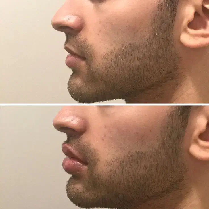 خدمات ژل ، بوتاکس، مزوتراپی ،فشیال و کامپوزیت|خدمات آرایشگری و زیبایی|اهواز, ۲۴ متری|دیوار