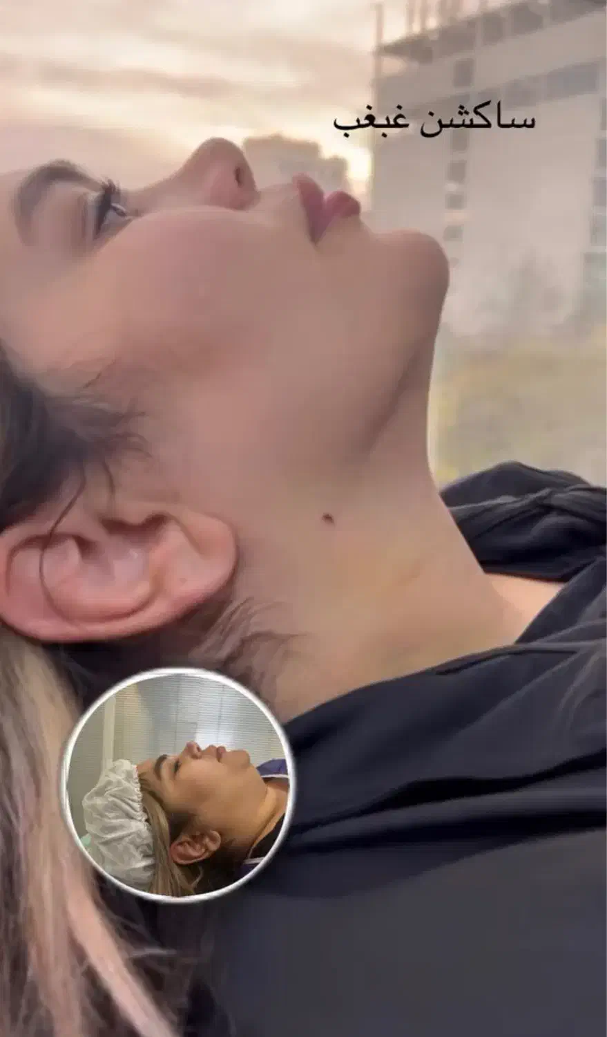 جراحی زیبایی با قیمت فوق العاده مناسب|خدمات آرایشگری و زیبایی|ساری, |دیوار