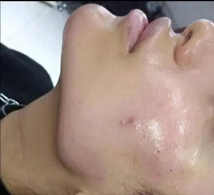 تخفیف باورنکردنی ژل، بوتاکس، آموزش|خدمات آرایشگری و زیبایی|شیراز, معالی‌آباد|دیوار
