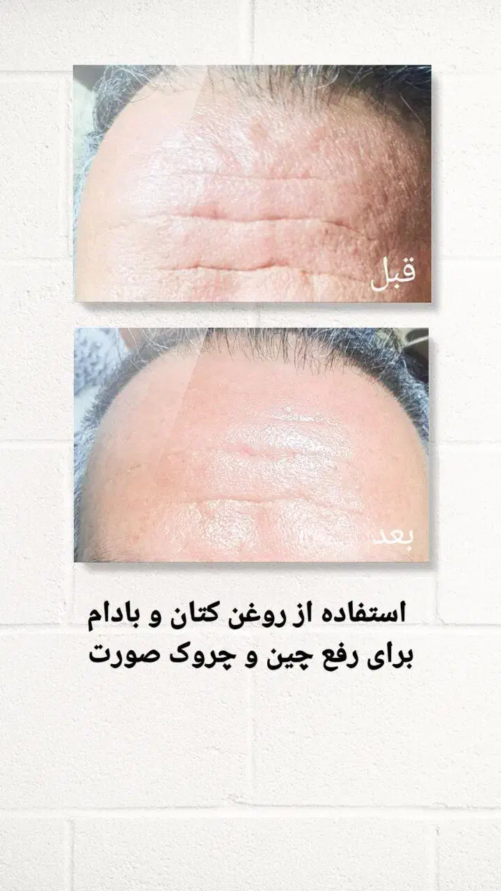 راه کار در منزل|آرایشی، بهداشتی، درمانی|لامرد, |دیوار