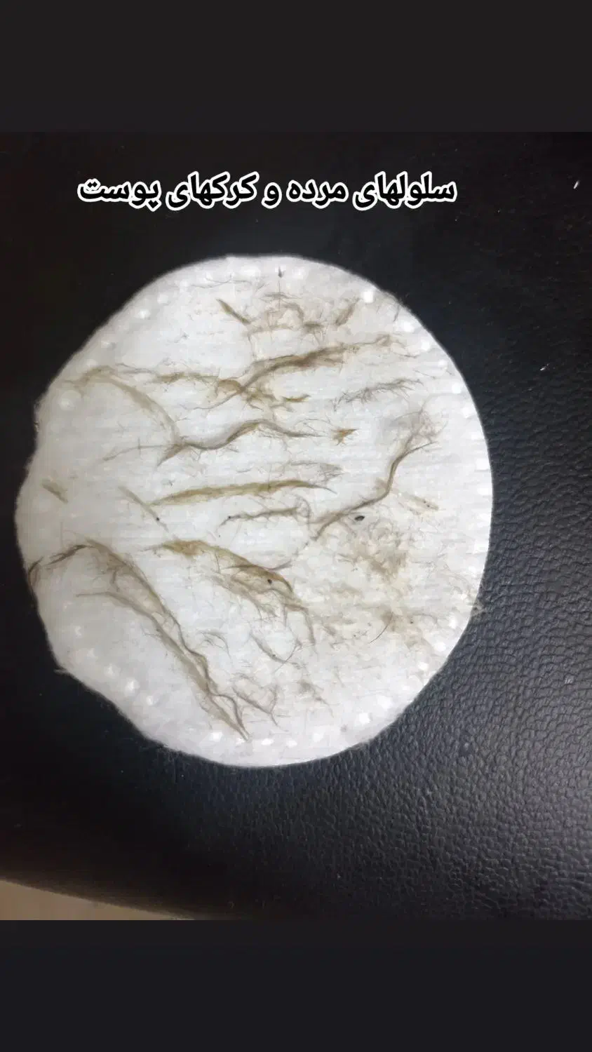 پا.کسازی پوست ۴۸۰|آرایشی، بهداشتی، درمانی|سنندج, |دیوار