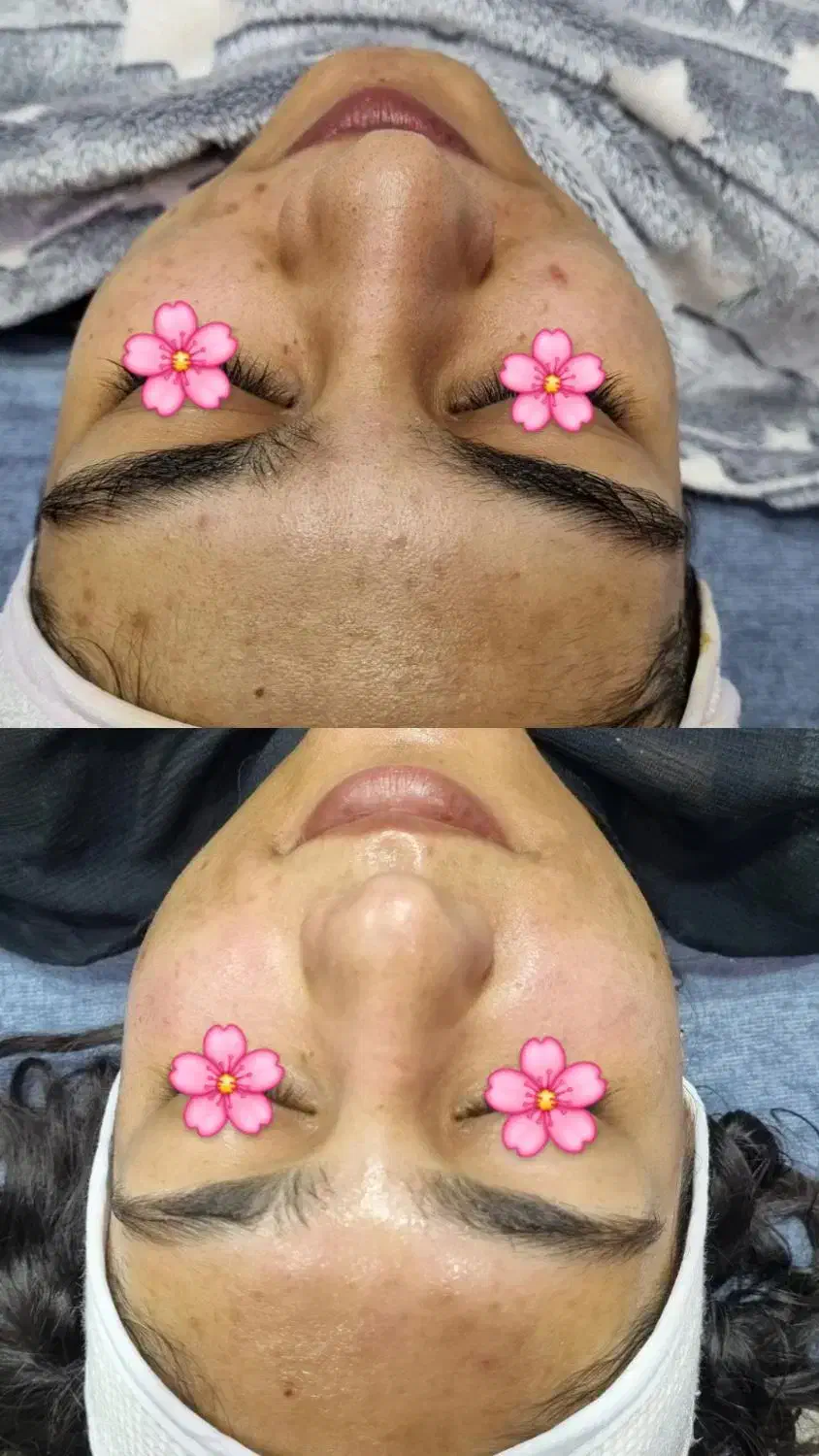 فیشیال تخصصی توسط پیراپزشک با۳۰٪تخفیف درکلینیک|خدمات آرایشگری و زیبایی|شیراز, خلدبرین|دیوار