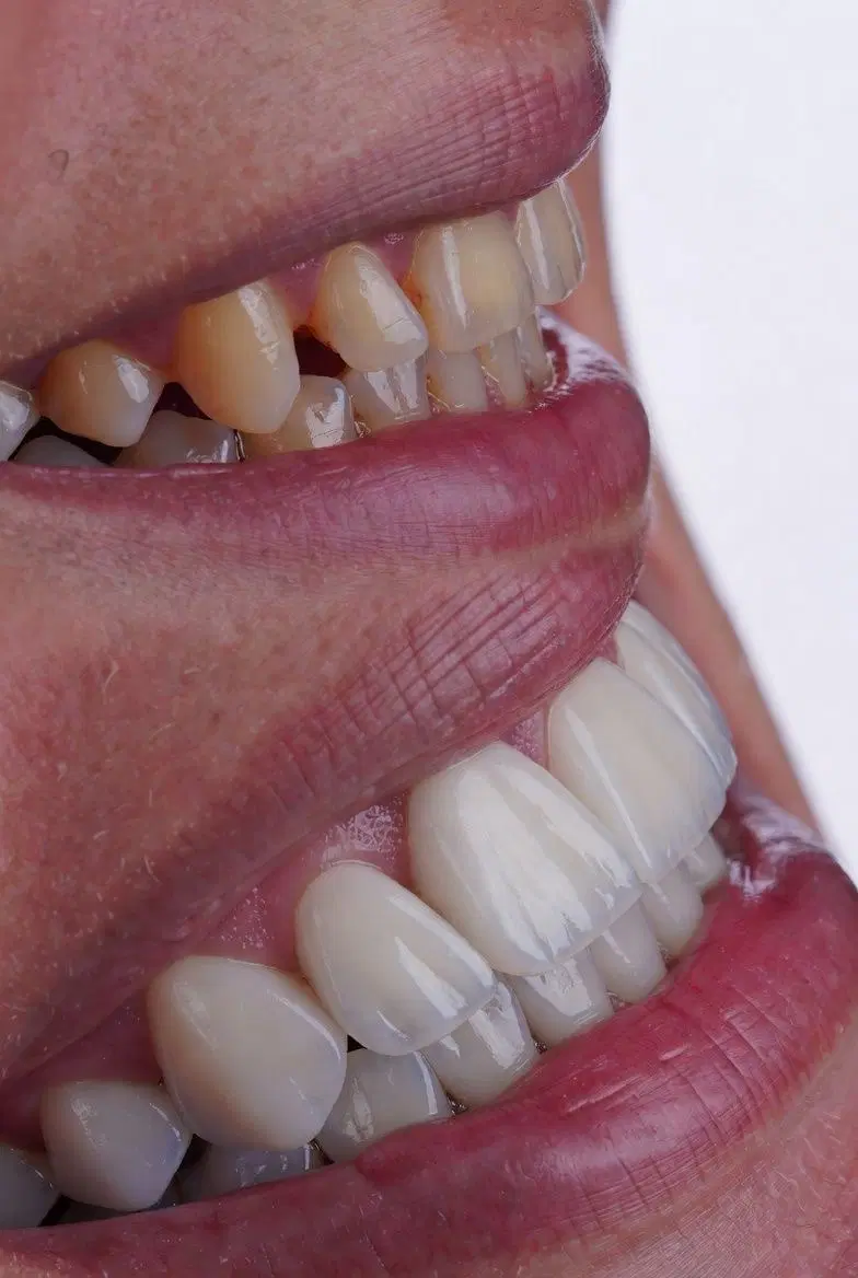 دندانپزشکی.کامپوزیت.لمینت|خدمات زیبایی و سلامت|تهران, سعادتآباد|دیوار